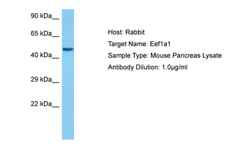 EEF1A1 Rabbit Polyclonal Antibody