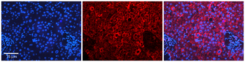 APEH Rabbit Polyclonal Antibody