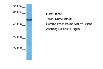 ATP5F1B Rabbit Polyclonal Antibody