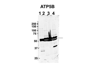 ATP5F1B Rabbit Polyclonal Antibody