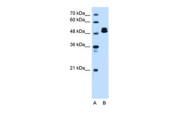 ATP5F1B Rabbit Polyclonal Antibody