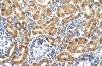 ENO3 Rabbit Polyclonal Antibody