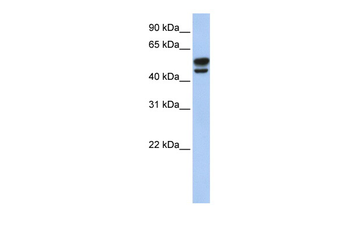 VIM Rabbit Polyclonal Antibody