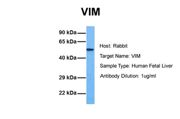 VIM Rabbit Polyclonal Antibody
