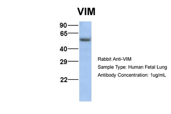 VIM Rabbit Polyclonal Antibody