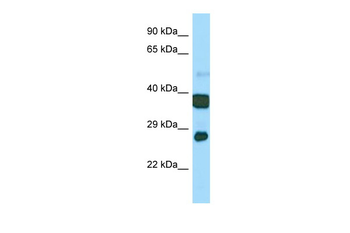 Atp5c1 Rabbit Polyclonal Antibody