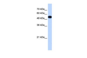 UGP2 Rabbit Polyclonal Antibody