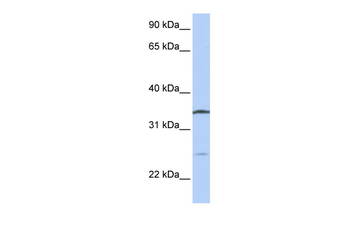 OCIAD1 Rabbit Polyclonal Antibody