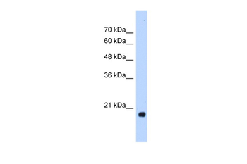 HSPB6 Rabbit Polyclonal Antibody