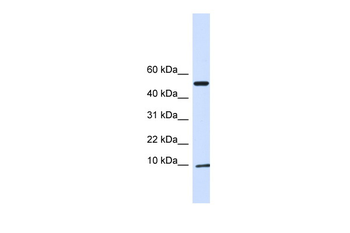 ATP5IF1 Rabbit Polyclonal Antibody