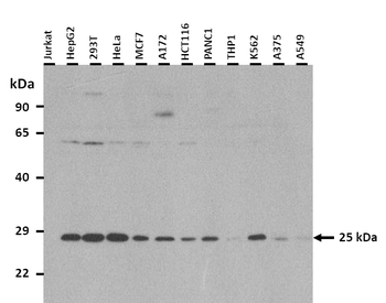 HPRT1 Rabbit Polyclonal Antibody