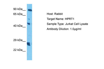 HPRT1 Rabbit Polyclonal Antibody