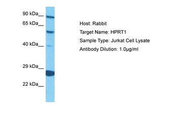 HPRT1 Rabbit Polyclonal Antibody