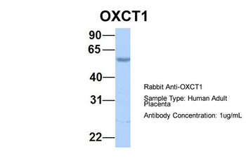 OXCT1 Rabbit Polyclonal Antibody