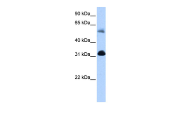 OXCT1 Rabbit Polyclonal Antibody