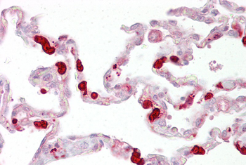GSTT1 Rabbit Polyclonal Antibody