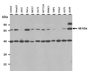 TKT Rabbit Polyclonal Antibody