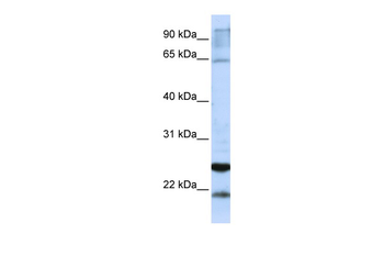 GSTA4 Rabbit Polyclonal Antibody