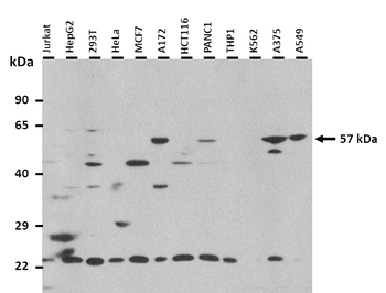 HMGCS1 Rabbit Polyclonal Antibody