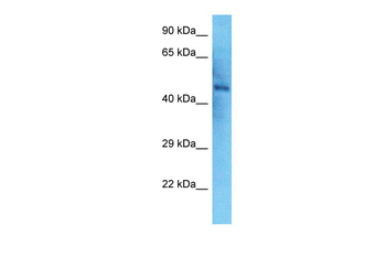 NEK2 Rabbit Polyclonal Antibody