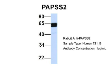 PAPSS2 Rabbit Polyclonal Antibody