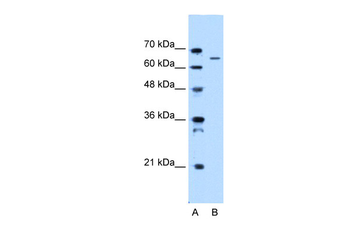 IVL Rabbit Polyclonal Antibody