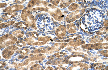 SDF2 Rabbit Polyclonal Antibody
