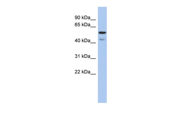 ATE1 Rabbit Polyclonal Antibody