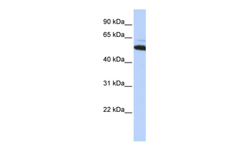 ATE1 Rabbit Polyclonal Antibody