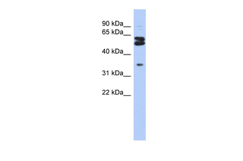 OGFOD1 Rabbit Polyclonal Antibody