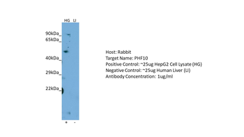 PHF10 Rabbit Polyclonal Antibody