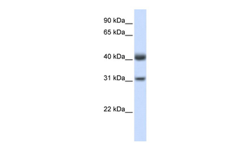 PDSS2 Rabbit Polyclonal Antibody