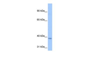 NSUN3 Rabbit Polyclonal Antibody