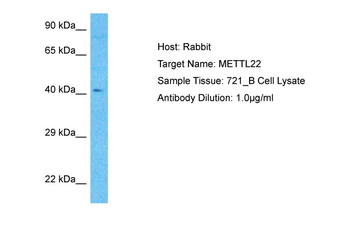 METTL22 Rabbit Polyclonal Antibody