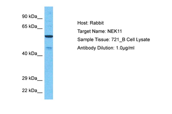 NEK11 Rabbit Polyclonal Antibody