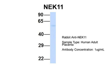 NEK11 Rabbit Polyclonal Antibody