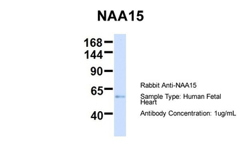NARG1 Rabbit Polyclonal Antibody