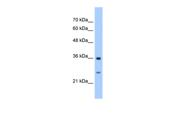 GSTZ1 Rabbit Polyclonal Antibody