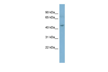 LYK5 Rabbit Polyclonal Antibody