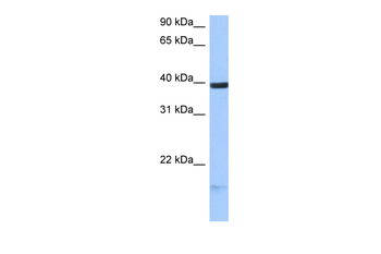 HS3ST5 Rabbit Polyclonal Antibody