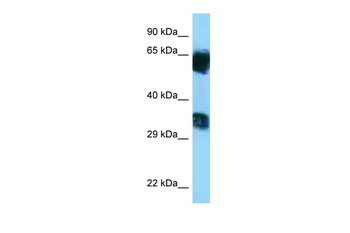 Mgat5b Rabbit Polyclonal Antibody