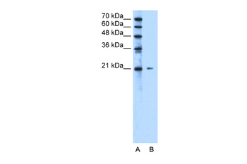 RAB5IF Rabbit Polyclonal Antibody