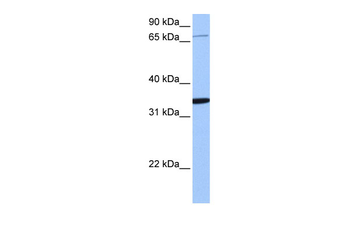 PCDHA10 Rabbit Polyclonal Antibody