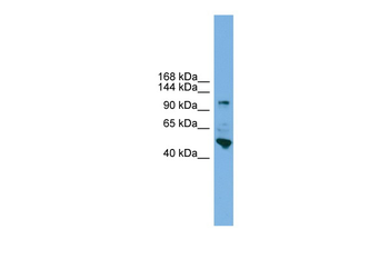 PCDH18 Rabbit Polyclonal Antibody