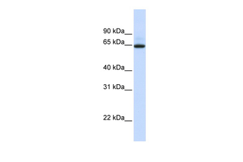 UGT1A7 Rabbit Polyclonal Antibody