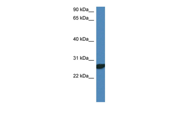 Ndfip2 Rabbit Polyclonal Antibody