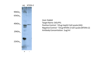 DOLPP1 Rabbit Polyclonal Antibody
