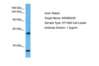 KIDINS220 Rabbit Polyclonal Antibody