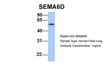 SEMA6D Rabbit Polyclonal Antibody