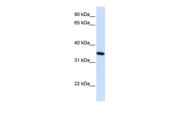 RTN1 Rabbit Polyclonal Antibody